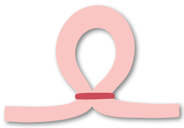 Icon for tubal ligation